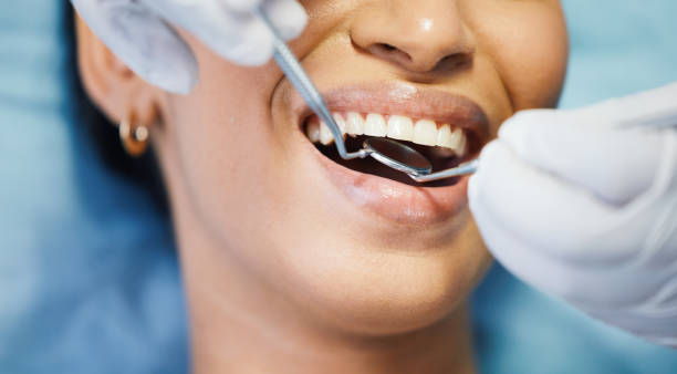 Best Emergency Treatment for Dental Infections or Abscesses in Ellensburg, WA