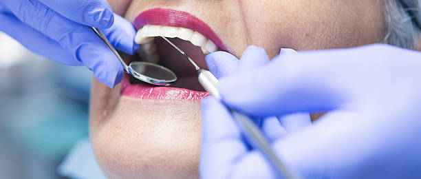 Best Emergency Tooth Extraction in Ellensburg, WA